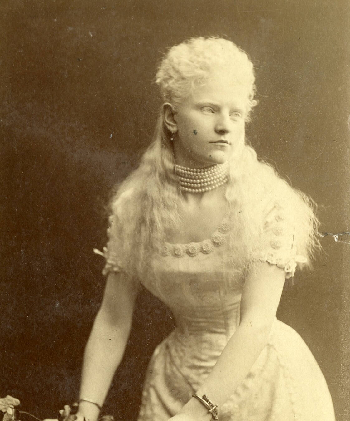 Black and white cabinet card photographic portrait of an albino woman wearing a dress, leaning against a prop log with leaves.